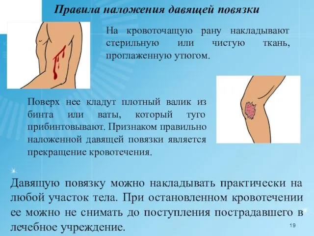 Правила наложения давящей повязки На кровоточащую рану накладывают стерильную или чистую