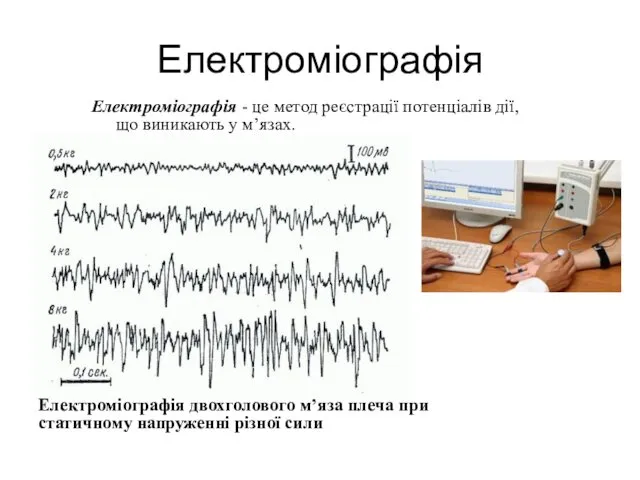 Електроміографія Електроміографія - це метод реєстрації потенціалів дії, що виникають у
