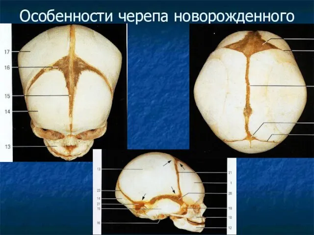 Особенности черепа новорожденного