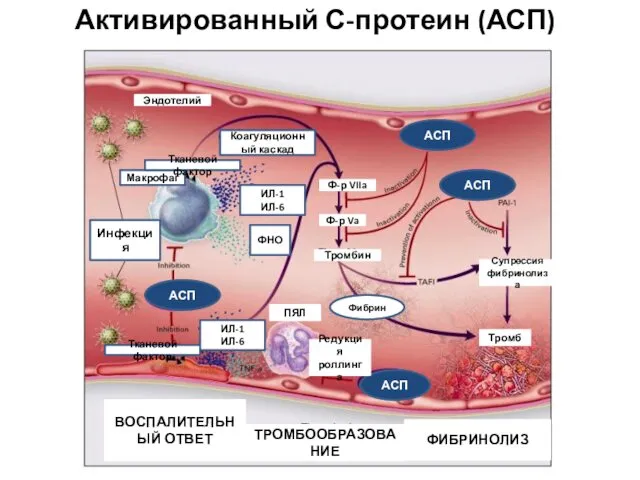 Активированный С-протеин (АСП) Инфекция Макрофаг Тканевой фактор ИЛ-1 ИЛ-6 ФНО Коагуляционный