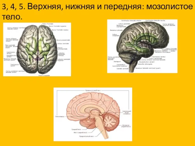 3, 4, 5. Верхняя, нижняя и передняя: мозолистое тело.