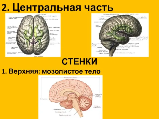 2. Центральная часть СТЕНКИ 1. Верхняя: мозолистое тело