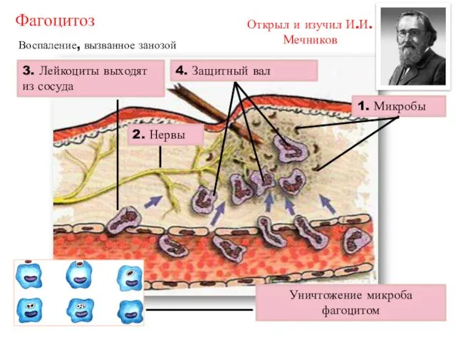 Фагоцитоз Открыл и изучил И.И.Мечников Воспаление, вызванное занозой 3. Лейкоциты выходят