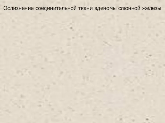 Ослизнение соединительной ткани аденомы слюнной железы