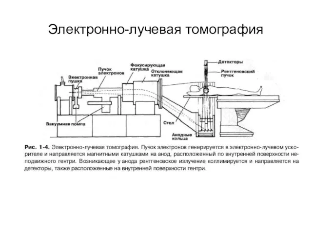 Электронно-лучевая томография