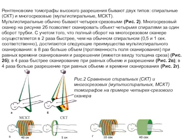 Рентгеновские томографы высокого разрешения бывают двух типов: спиральные (СКТ) и многосрезовые