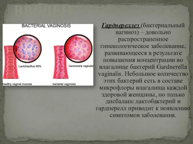 Гарднереллез (бактериальный вагиноз) – довольно распространенное гинекологическое заболевание, развивающееся в результате