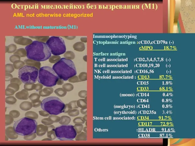 Острый миелолейкоз без вызревания (М1) Immunophenotyping Cytoplasmic antigen :cCD3,cCD79a (-) cMPO