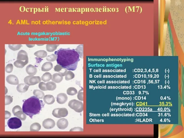 Острый мегакариолейкоз (М7) Immunophenotyping Surface antigen T cell associated :CD2,3,4,5,8 (-)