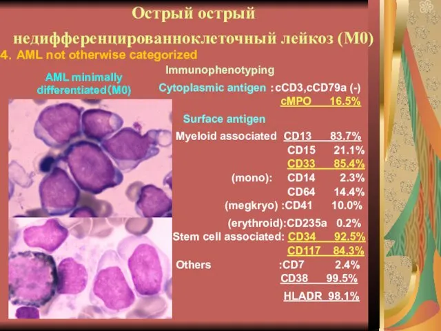 Острый острый недифференцированноклеточный лейкоз (М0) Immunophenotyping Cytoplasmic antigen ：cCD3,cCD79a (-) Surface