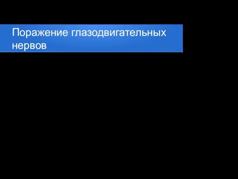 Поражение глазодвигательных нервов