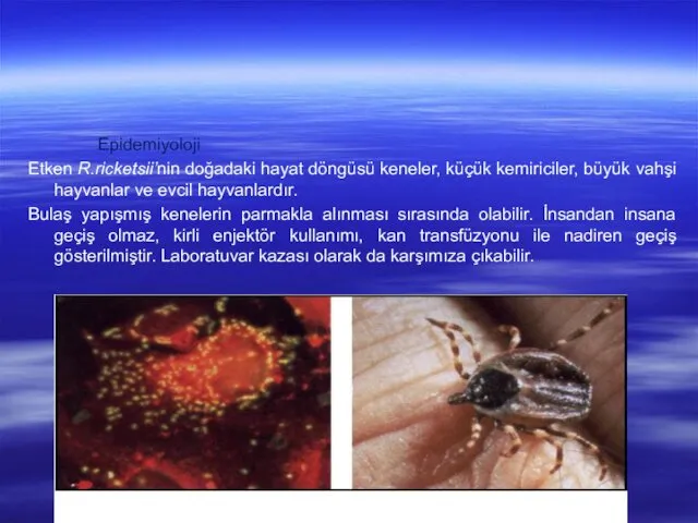 Epidemiyoloji Etken R.ricketsii’nin doğadaki hayat döngüsü keneler, küçük kemiriciler, büyük vahşi