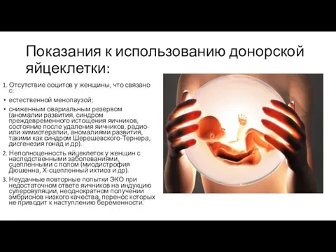 Показания к использованию донорской яйцеклетки: 1. Отсутствие ооцитов у женщины, что