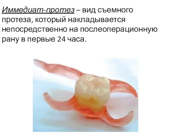 Иммедиат-протез – вид съемного протеза, который накладывается непосредственно на послеоперационную рану в первые 24 часа.