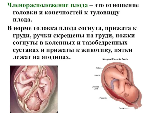 Членорасположение плода – это отношение головки и конечностей к туловищу плода.