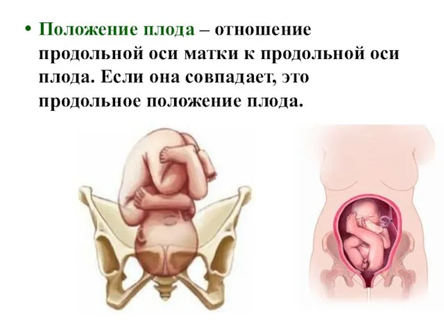 Положение плода – отношение продольной оси матки к продольной оси плода.