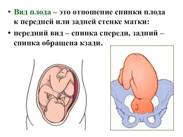 Вид плода – это отношение спинки плода к передней или задней