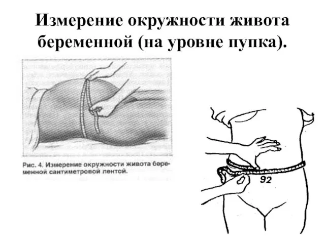 Измерение окружности живота беременной (на уровне пупка).