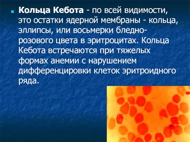 Кольца Кебота - по всей видимости, это остатки ядерной мембраны -