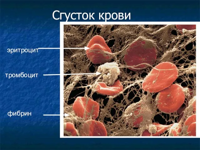 Сгусток крови фибрин тромбоцит эритроцит