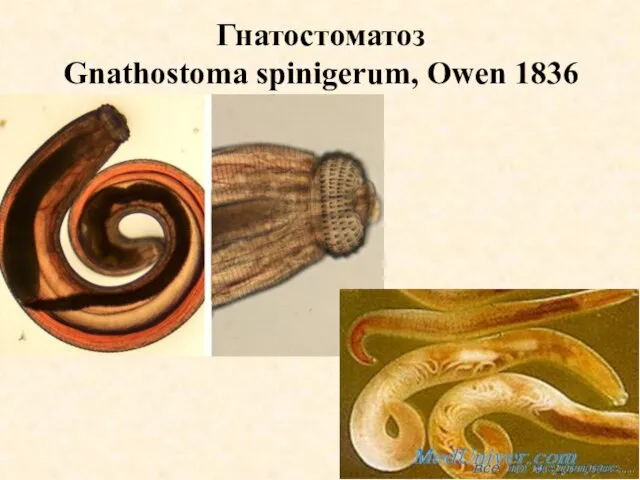 Гнатостоматоз Gnathostoma spinigerum, Owen 1836