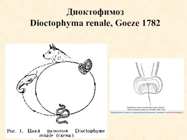 Диоктофимоз Dioctophyma renale, Goeze 1782