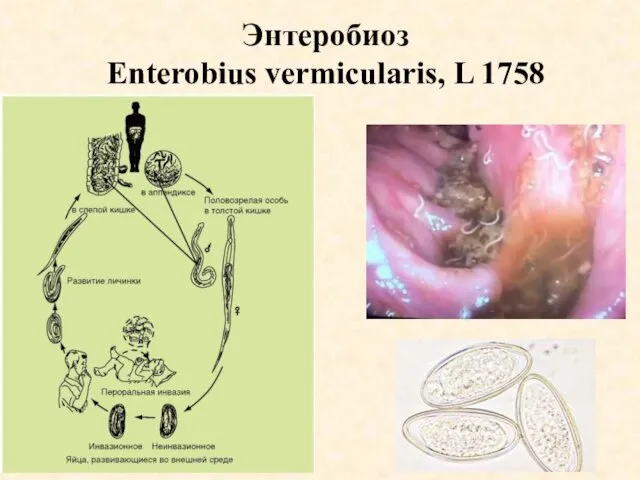 Энтеробиоз Enterobius vermicularis, L 1758