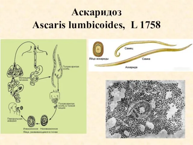 Аскаридоз Ascaris lumbicoides, L 1758