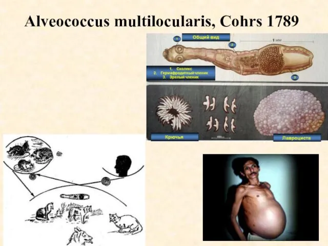 Alveococcus multilocularis, Cohrs 1789