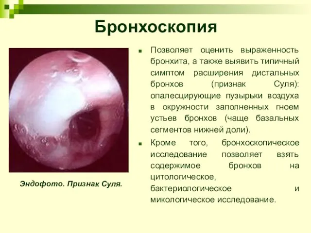 Бронхоскопия Позволяет оценить выраженность бронхита, а также выявить типичный симптом расширения