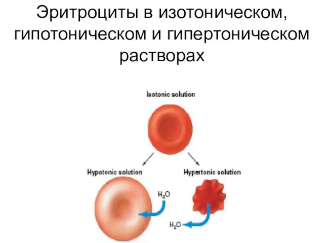 Эритроциты в изотоническом, гипотоническом и гипертоническом растворах