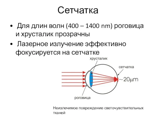 Сетчатка Для длин волн (400 – 1400 nm) роговица и хрусталик