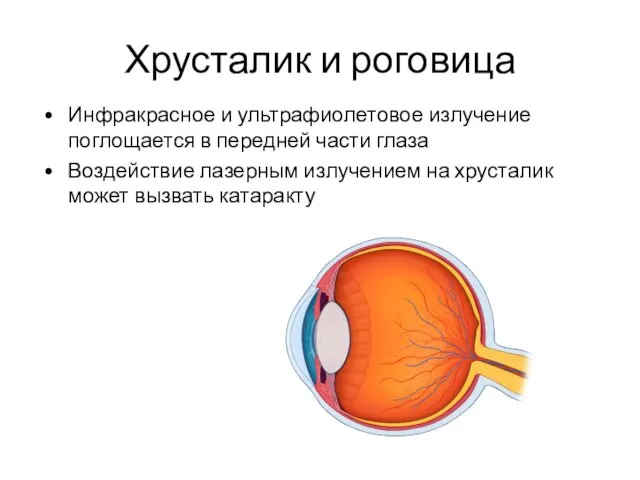 Хрусталик и роговица Инфракрасное и ультрафиолетовое излучение поглощается в передней части