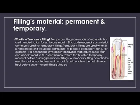 Filling’s material: permanent & temporary. What is a Temporary Filling? Temporary