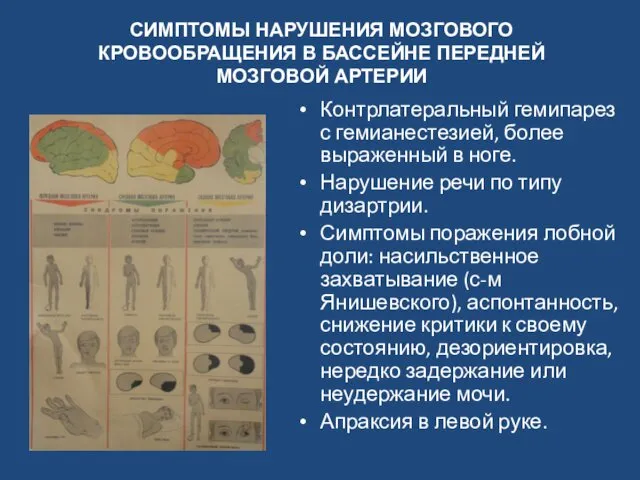 СИМПТОМЫ НАРУШЕНИЯ МОЗГОВОГО КРОВООБРАЩЕНИЯ В БАССЕЙНЕ ПЕРЕДНЕЙ МОЗГОВОЙ АРТЕРИИ Контрлатеральный гемипарез