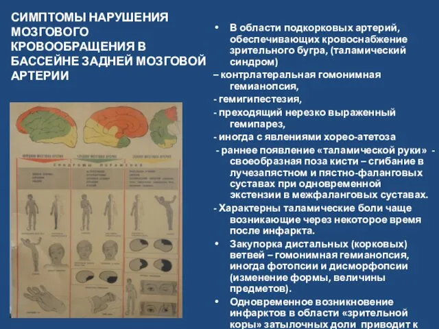 СИМПТОМЫ НАРУШЕНИЯ МОЗГОВОГО КРОВООБРАЩЕНИЯ В БАССЕЙНЕ ЗАДНЕЙ МОЗГОВОЙ АРТЕРИИ В области