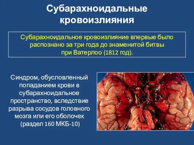 Синдром, обусловленный попаданием крови в субарахноидальное пространство, вследствие разрыва сосудов головного