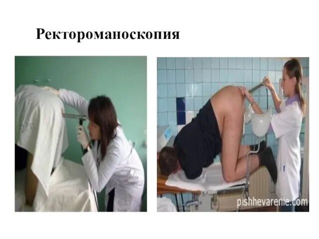 Ректороманоскопия