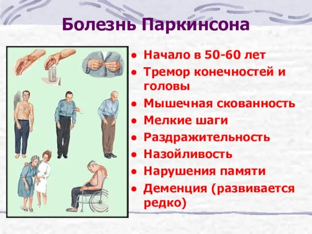 Болезнь Паркинсона Начало в 50-60 лет Тремор конечностей и головы Мышечная