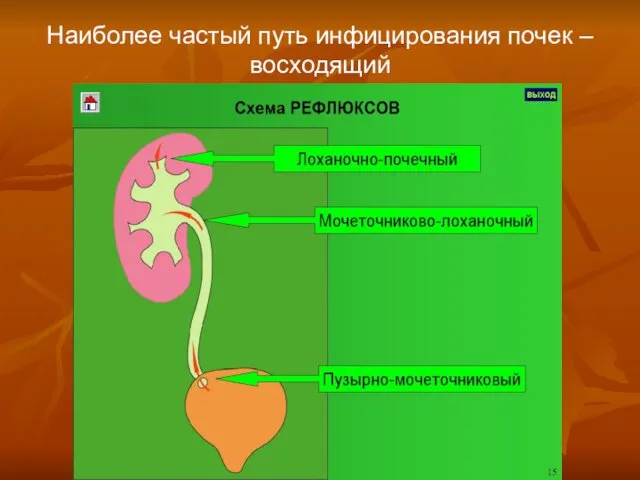 Наиболее частый путь инфицирования почек – восходящий