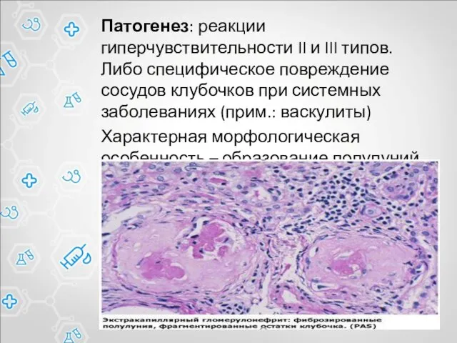 Патогенез: реакции гиперчувствительности II и III типов. Либо специфическое повреждение сосудов