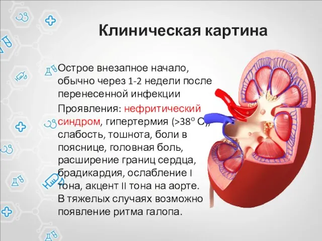 Клиническая картина Острое внезапное начало, обычно через 1-2 недели после перенесенной