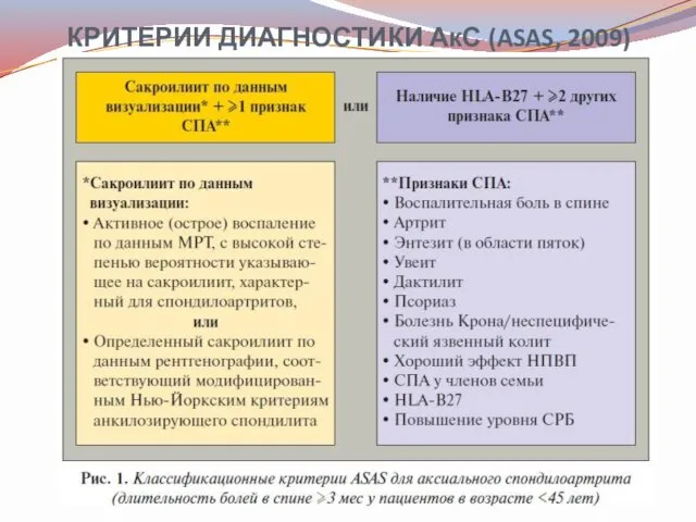 КРИТЕРИИ ДИАГНОСТИКИ АкС (ASAS, 2009)