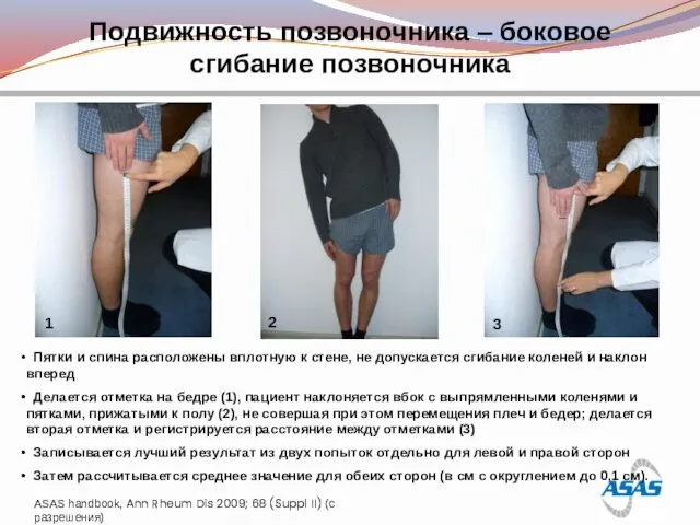 Подвижность позвоночника – боковое сгибание позвоночника ASAS handbook, Ann Rheum Dis