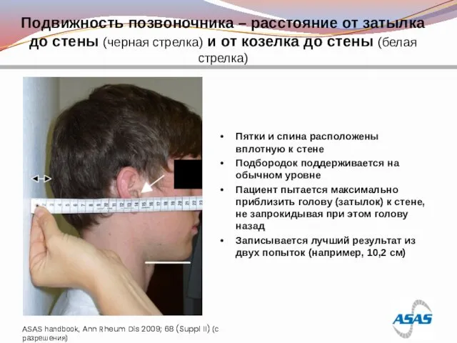 Подвижность позвоночника – расстояние от затылка до стены (черная стрелка) и