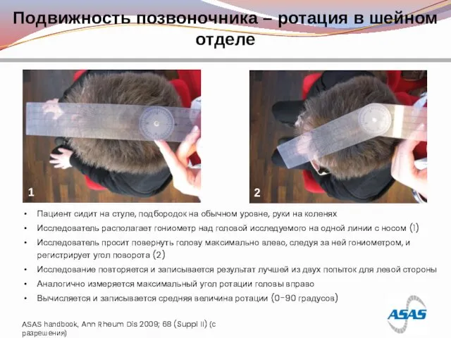 Подвижность позвоночника – ротация в шейном отделе 1 2 Пациент сидит