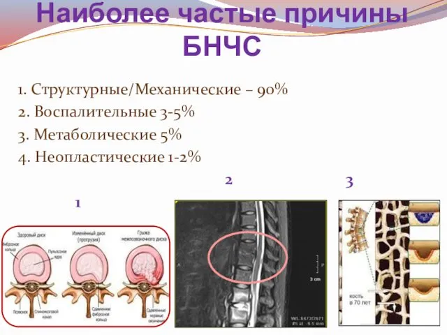 Наиболее частые причины БНЧС 1. Структурные/Механические – 90% 2. Воспалительные 3-5%