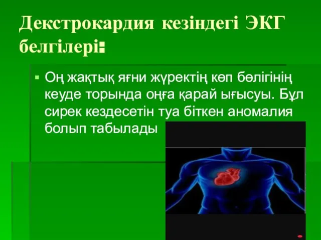 Декстрокардия кезіндегі ЭКГ белгілері: Оң жақтық яғни жүректің көп бөлігінің кеуде