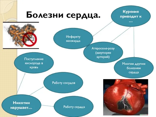 Болезни сердца. Курение приводит к … Атероскле-розу(закупорке артерий) Инфаркту миокарда Многим