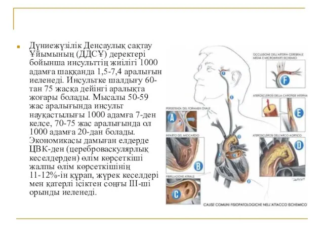 Дүниежүзілік Денсаулық сақтау Ұйымының (ДДСҰ) деректері бойынша инсульттің жиілігі 1000 адамға